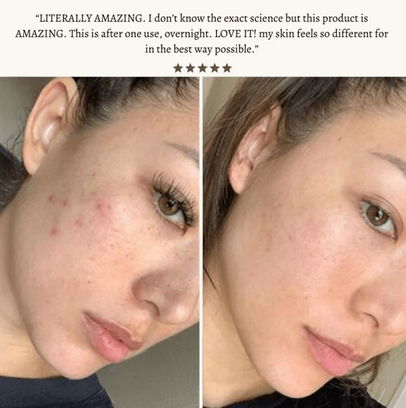 High Frequency Skin Therapy Wand - NoveltyExpress