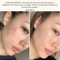 High Frequency Skin Therapy Wand - NoveltyExpress